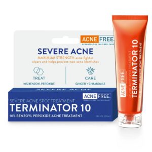 ACNE FREE Terminator 10 Acne Spot Treatment Cream with 10% Benzoyl Peroxide 30ml.